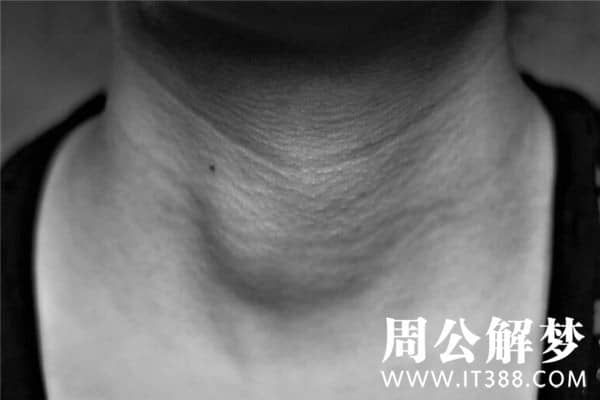 梦见长肉瘤是什么意思 梦见长肉瘤是什么意思