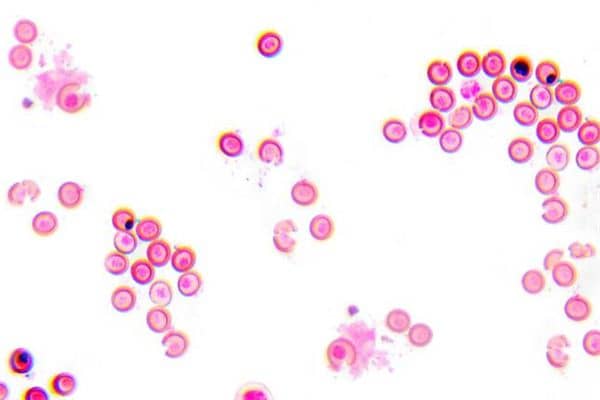 梦见绦虫是什么意思 梦见绦虫是什么意思