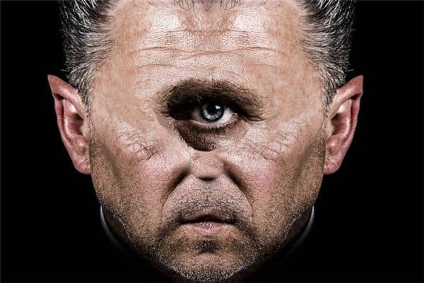 梦见单眼是什么意思 梦见单眼是什么意思