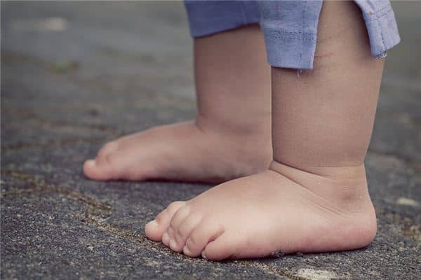 梦见脚肿是什么意思 梦见脚肿是什么意思