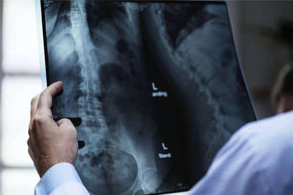 梦见骨科医生是什么意思 梦见骨科医生是什么意思