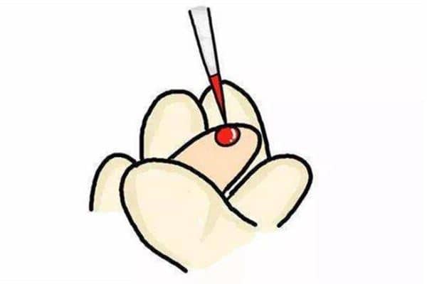 梦见别人身上有血是什么预兆 梦见别人身上有血是什么预兆