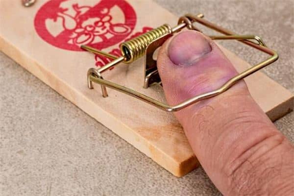 梦见手肿是什么意思 梦见手肿是什么意思