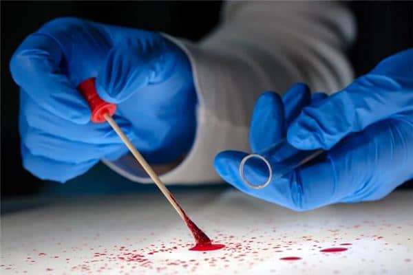 梦见尿血是什么意思 梦见尿血是什么意思