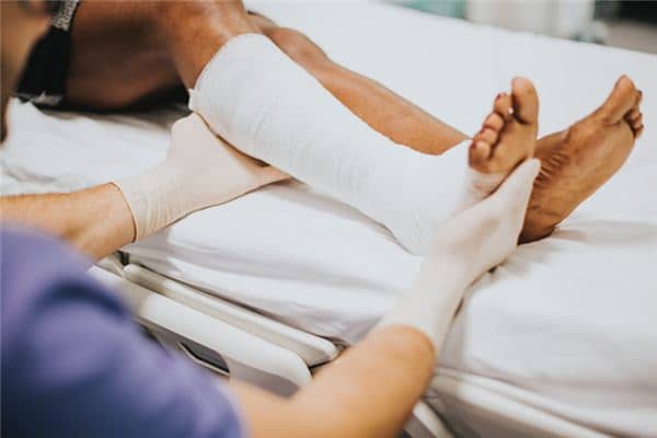 梦见断腿是什么意思 梦见断腿是什么意思