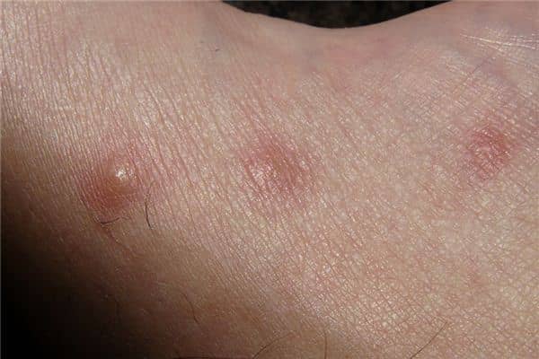 梦见身上痒是什么意思 梦见身上痒是什么意思