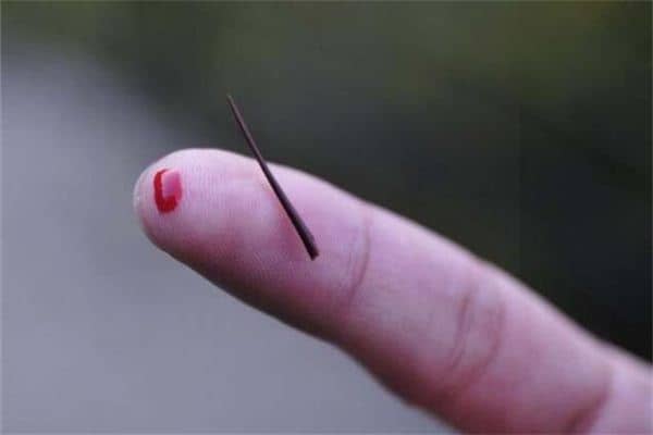 梦见刺与刺伤刺痛