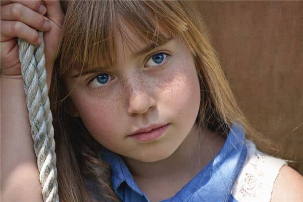 梦见雀斑是什么意思 梦见雀斑是什么意思