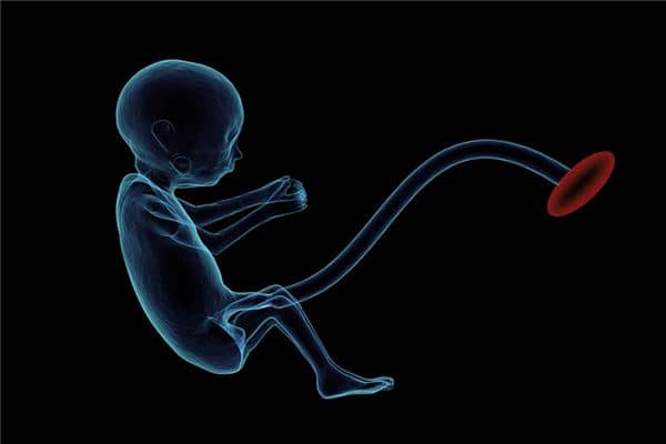 梦见死胎是什么意思 梦见死胎是什么意思