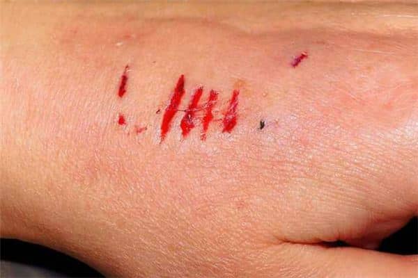 周公解梦梦到被狗咬 周公解梦梦到被狗咬