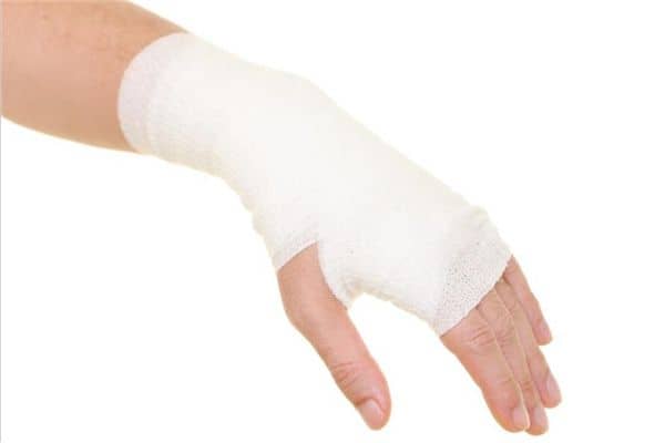 梦见商人手臂断了