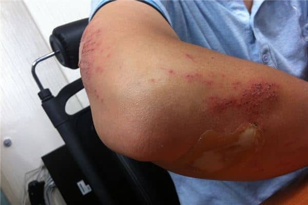 梦见孩子受伤 梦见孩子受伤