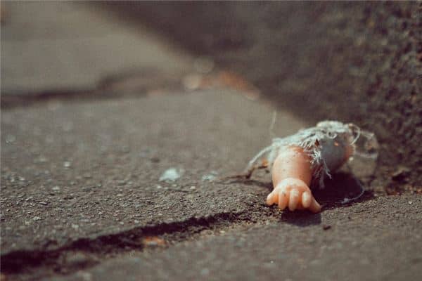 梦见手臂断了 梦见手臂断了