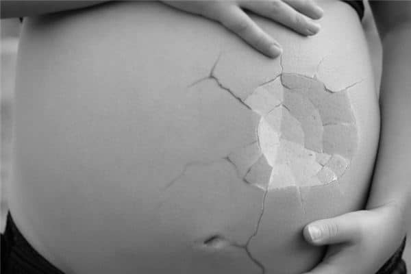 梦见流产出血 梦见流产出血