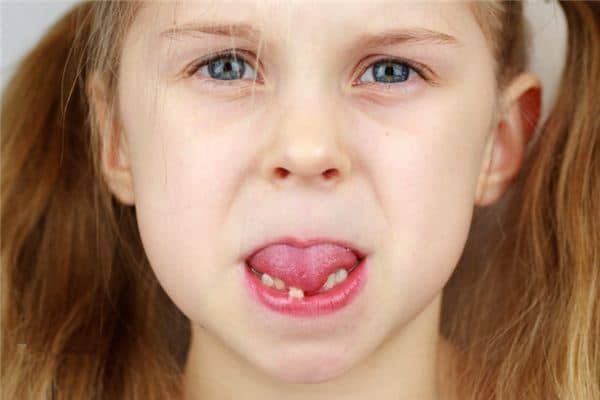 梦见下牙松动 梦见下牙松动