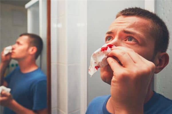 梦见鼻子受伤 梦见鼻子受伤