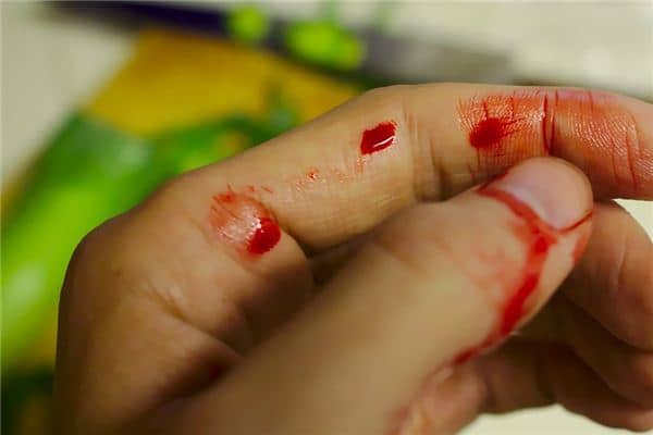 梦见手指出血 梦见手指出血