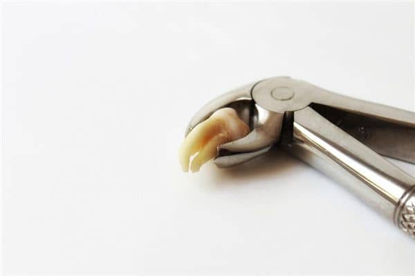 做梦拔牙是什么意思 做梦拔牙是什么意思