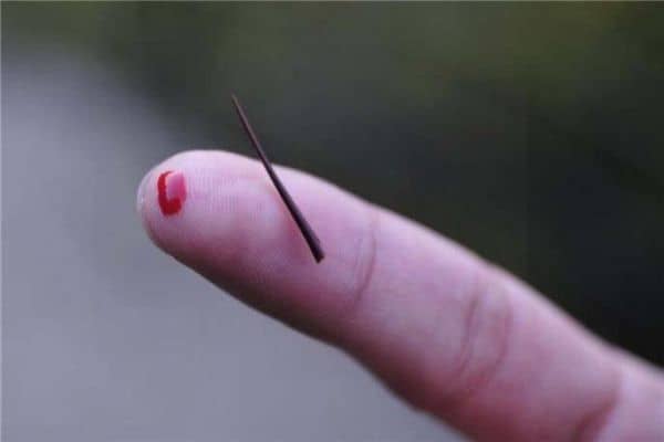 梦见手指被扎
