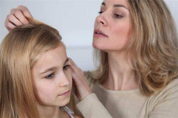 做梦梦见头上长虱子 做梦梦见头上长虱子