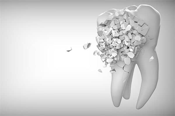 梦见牙碎了是什么意思 梦见牙碎了是什么意思