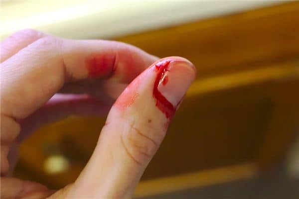梦见自己流血是什么预兆 梦见自己流血是什么预兆