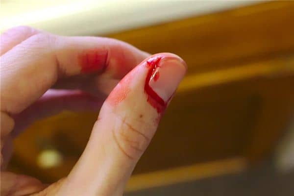 梦见手流血是什么预兆 梦见手流血是什么预兆
