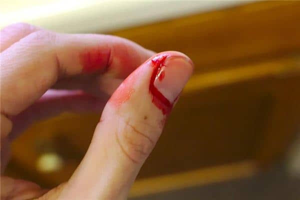 梦见手指断是什么意思 梦见手指断是什么意思