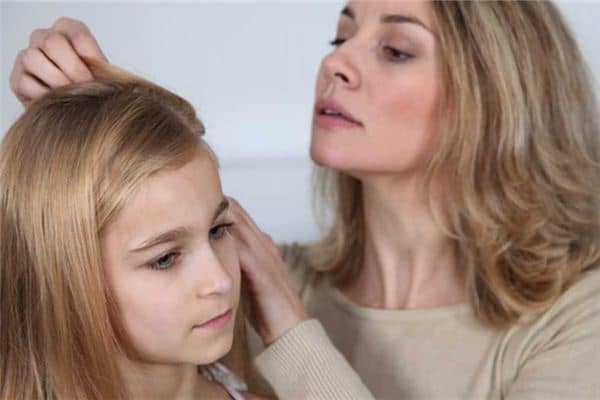 梦到自己头上长虱子