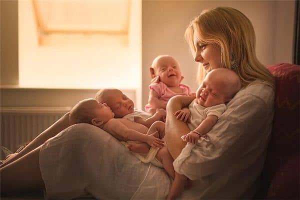 梦见四胞胎是什么预兆 梦见四胞胎是什么预兆