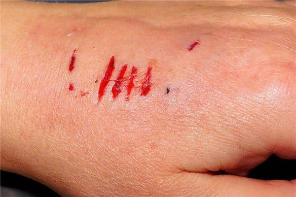 梦见狗咬出血 梦见狗咬出血