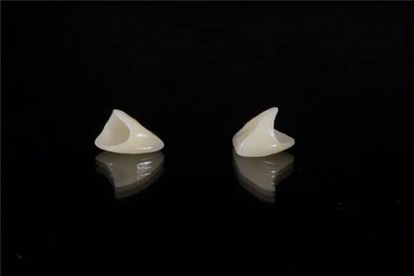 梦见掉上牙是什么意思 梦见掉上牙是什么意思