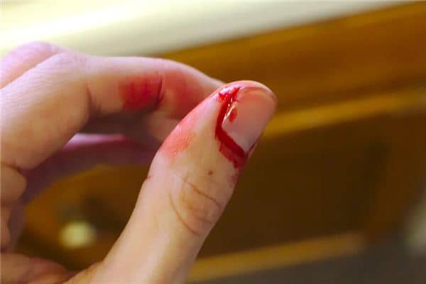 梦见亲人流血是什么意思 梦见亲人流血是什么意思