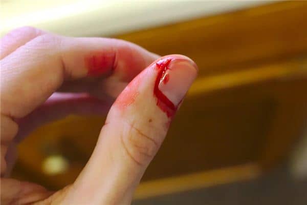 梦见断手指是什么意思 梦见断手指是什么意思