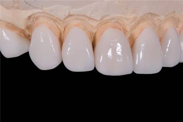 梦见落牙齿是什么意思 梦见落牙齿是什么意思