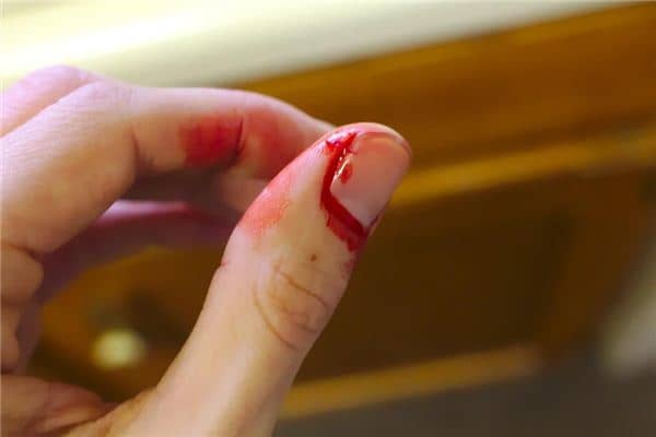 梦见手割破了是什么意思