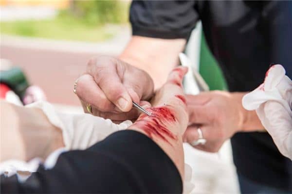 梦见胳膊流血是什么意思 梦见胳膊流血是什么意思