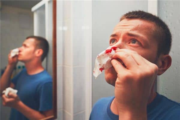 梦见鼻子流血是什么意思 梦见鼻子流血是什么意思