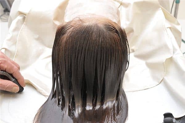 梦见头皮掉了是什么意思 梦见头皮掉了是什么意思