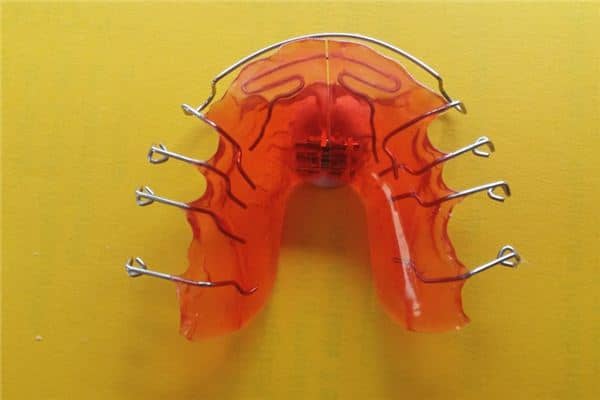 梦见牙套掉了是什么意思 梦见牙套掉了是什么意思