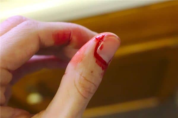 梦见手被割破是什么意思 梦见手被割破是什么意思
