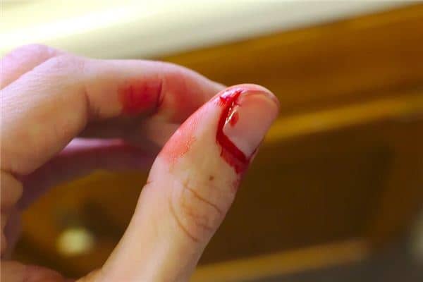 梦见被砍手指是什么意思 梦见被砍手指是什么意思