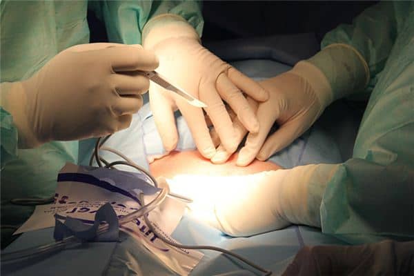 梦见动手术了是什么意思 梦见动手术了是什么意思