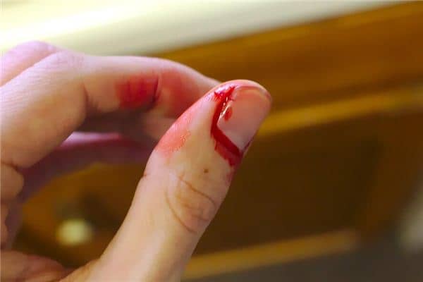 梦见手上沾血是什么意思 梦见手上沾血是什么意思