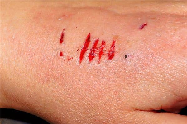 梦见被狗咬出血 梦见被狗咬出血