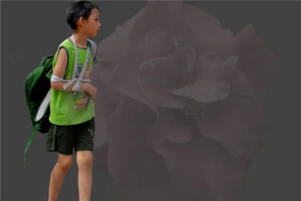 梦见儿子受伤严重是什么意思