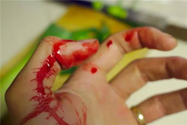 梦见出血是什么意思