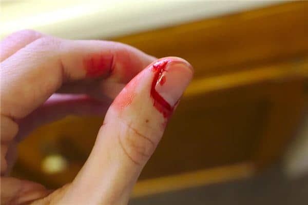 梦见咬别人手指是什么意思