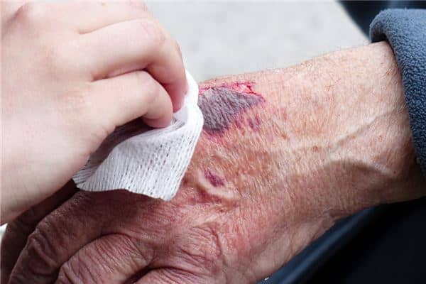 梦见伤口裂开没流血是什么意思