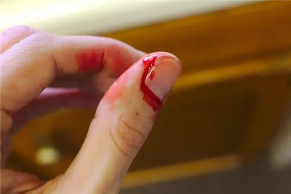 梦见自己手流血是什么意思